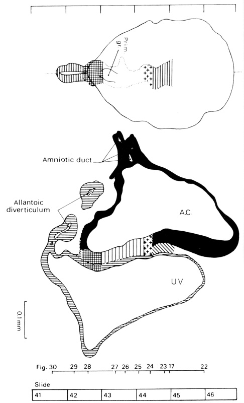 Dorsal view and median reconstruction in alignment
