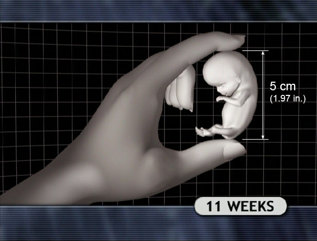 11 Week Fetus