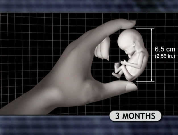 3 Month Fetus