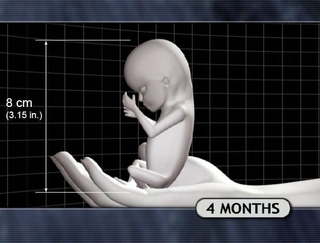 4 Month Fetus