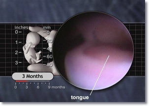 3 months, Fetus, Mouth, Tongue
