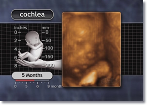 5 month fetus cochlea, ear
