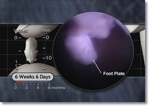 6 weeks 6 days Embryo foot plate, metatarsal bones