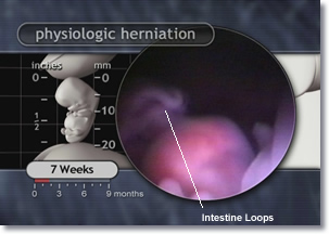 Physiologic herniation, intestine loops, appendix, and umbilical cord of the 7 week embryo.