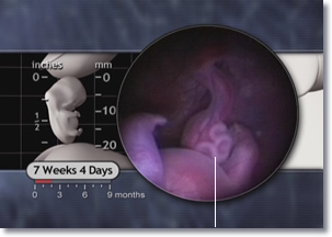  7 weeks 4 days Embryo intestines, physiologic herniation