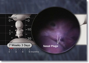 Embryo nose, nasal plugs, 7 weeks 3 days