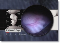 7 weeks 3 days Embryo toes, notched toes, embryo feet, embryo foot