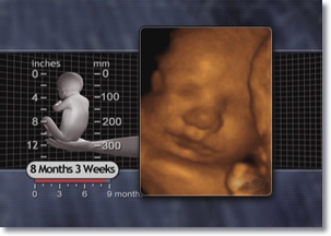 Eight (8) Month 3 weeks Fetus, 3D Ultrasound