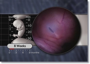 eyelids fuse, 8 week embryo