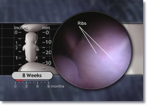 Embryo Ribs, 8 weeks