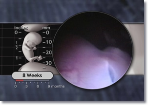 Brain of 8 week embryo