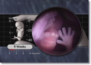 9 weeks Fetus Nose, Nasal Plugs, hands, fingers