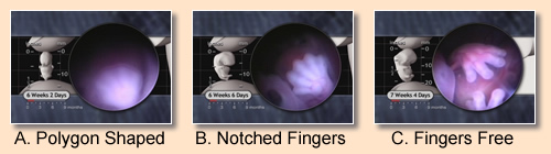 Embryo Hand Development Progression: polygon shaped, notched fingers, fingers free