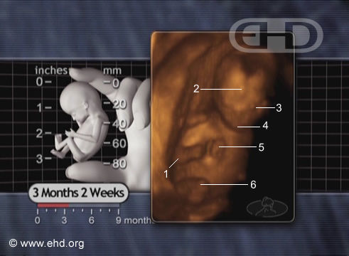 The 3½-Month Fetus [Click for next image]