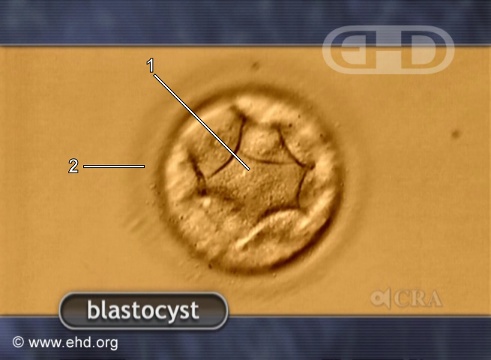 Blastocisto [Clique para a próxima imagem]
