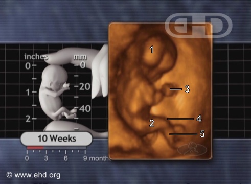 The 10-Week Fetus