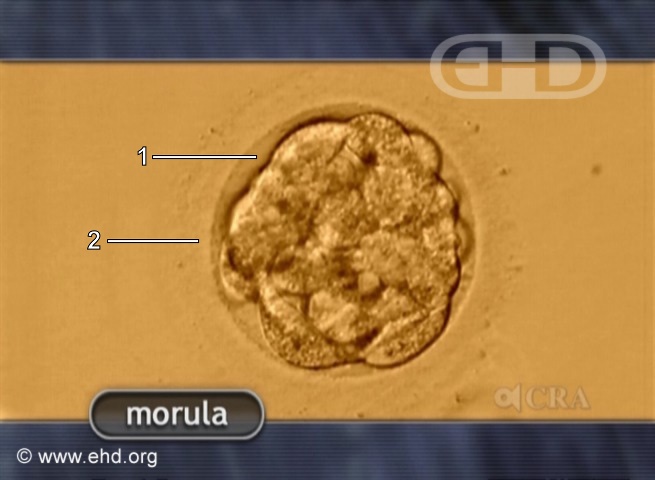 The Human Morula [Click for next image]