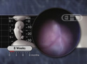 Eye & Nose, Eight-Week Embryo