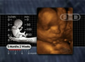 Face, 22-Week Fetus