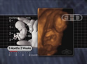 El feto de 3½ meses