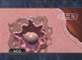 Early Placenta Formation