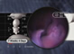 The Umbilical Cord at 7 1/2 Weeks