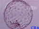 Free Blastocyst  (without zona)