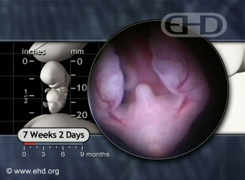 Lower Embryo at 7 Weeks, 2 Days