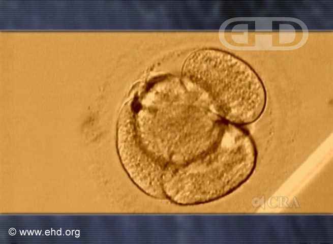 Four-Cell Human Embryo