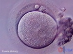 Single-Cell Embryo