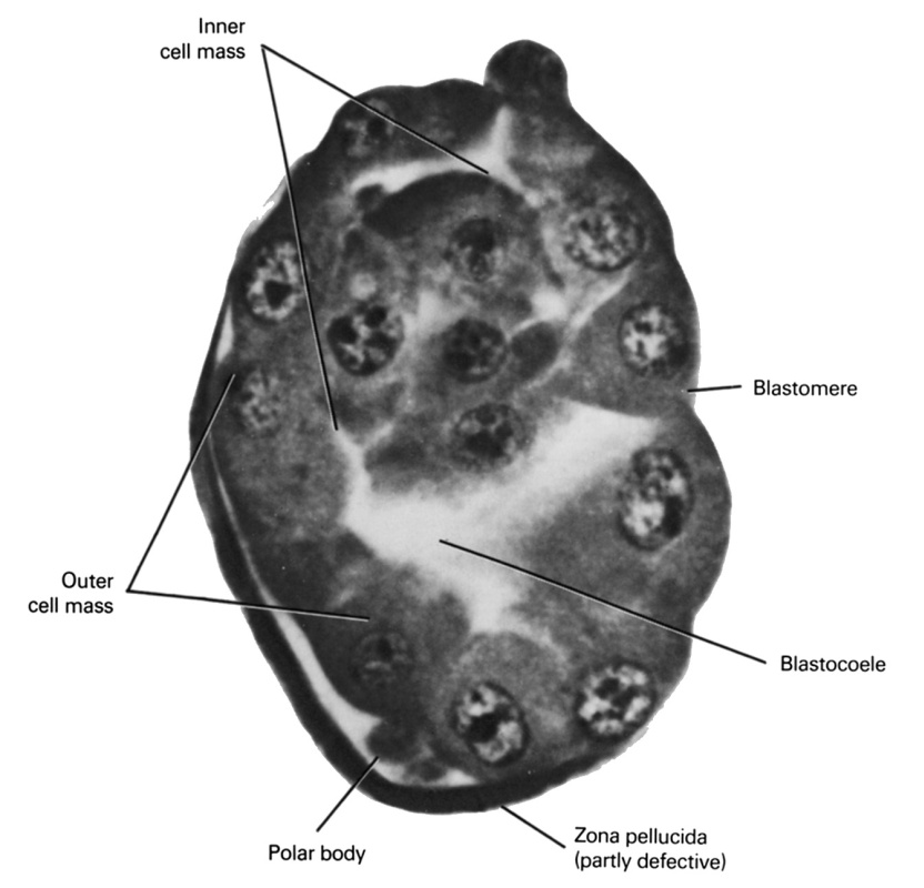 blastocystic cavity (blastocoele), blastomere, inner cell mass (embryoblast), outer cell mass, zona pellucida
