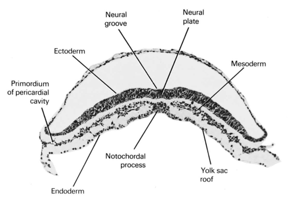 ectoderm, endoderm, mesoderm, neural groove, neural plate, notochordal process, primordial pericardial cavity, umbilical vesicle roof