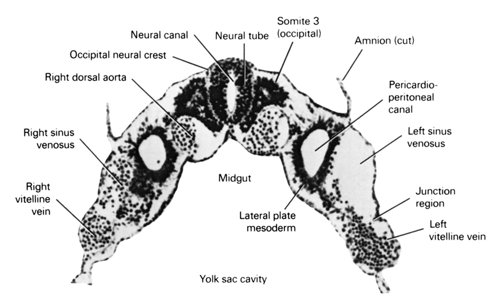 cut edge of amnion, junction region, lateral plate mesoderm, left sinus venosus, left vitelline (omphalomesenteric) vein, midgut, neural canal, neural tube, occipital neural crest, pericardioperitoneal canal (pleural cavity), right dorsal aorta, right horn of sinus venosus, right vitelline (omphalomesenteric) vein, somite 3 (O-3), umbilical vesicle cavity