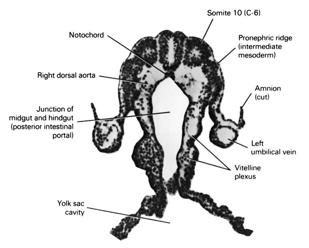 caudal intestinal portal, cut edge of amnion, junction of hindgut and midgut, left umbilical vein, notochord, pronephric ridge (intermediate mesoderm), right dorsal aorta, somite 10 (C-6), umbilical vesicle cavity, vitelline plexus