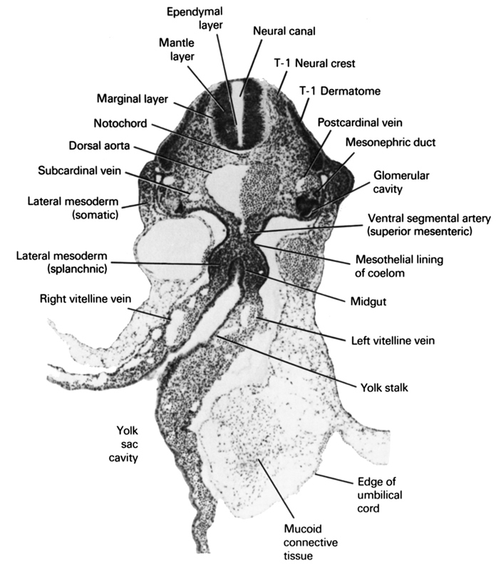 T-1 dermatome, T-1 neural crest, dorsal aorta, edge of umbilical cord, ependymal layer, glomerular cavity, lateral mesoderm (somatic), lateral mesoderm (splanchnic), left vitelline (omphalomesenteric) vein, mantle layer, marginal layer, mesonephric duct, mesothelial lining of coelom, midgut, mucoid connective tissue, neural canal, notochord, postcardinal vein, right vitelline (omphalomesenteric) vein, subcardinal vein, ventral segmental artery (superior mesenteric), yolk sac, yolk sac cavity