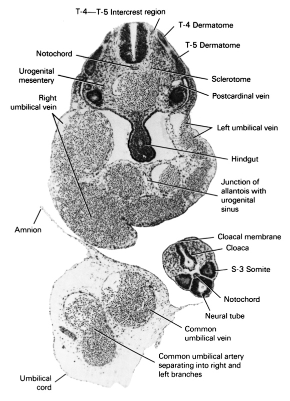 S-3 somite, T-4 dermatome, T-4-T-5 intercrest region, T-5 dermatome, amnion, cloaca, cloacal membrane, common umbilical artery separating into right and left branches, common umbilical vein, hindgut, junction of allantois with urogenital sinus, left umbilical vein, neural tube, notochord, postcardinal vein, right umbilical vein, sclerotome, umbilical cord, urogenital mesentery