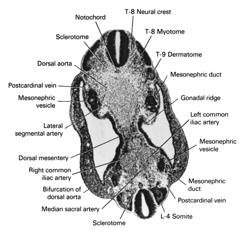 L-4 somite, T-8 myotome, T-8 neural crest, T-9 dermatome, bifurcation of dorsal aorta, dorsal aorta, dorsal mesentery, gonadal ridge, lateral segmental artery, left common iliac artery, median sacral artery, mesonephric duct, mesonephric vesicle, notochord, postcardinal vein, right common iliac artery, sclerotome