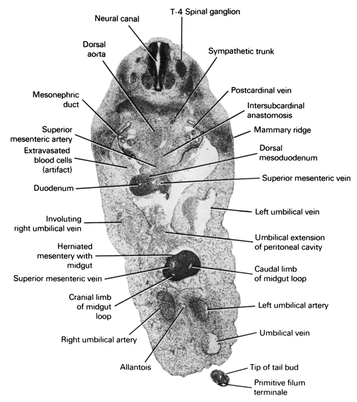 T-4 spinal ganglion, allantois, caudal limb of midgut loop, cranial limb of midgut loop, dorsal aorta, dorsal mesoduodenum, duodenum, extravasated blood cells (artifact), herniated mesentery with midgut, intersubcardinal anastomosis, involuting right umbilical vein, left umbilical artery, left umbilical vein, mammary ridge, mesonephric duct, neural canal, postcardinal vein, primitive filum terminale, right umbilical artery, superior mesenteric artery, superior mesenteric vein, sympathetic trunk, tip of tail bud, umbilical extension of peritoneal cavity, umbilical vein