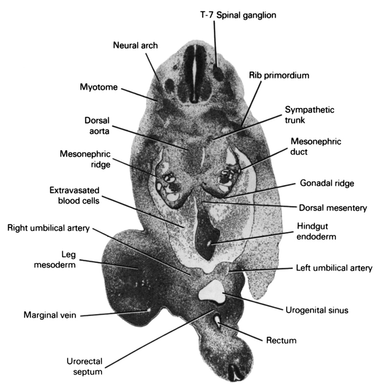 T-7 spinal ganglion, dorsal aorta, dorsal mesentery, extravasated blood cells, gonadal ridge, hindgut endoderm, left umbilical artery, leg mesoderm, marginal vein, mesonephric duct, mesonephric ridge, myotome, neural arch, rectum, rib primordium, right umbilical artery, sympathetic trunk, urogenital sinus, urorectal septum