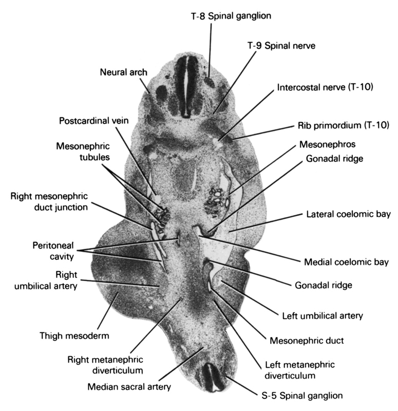 S-5 spinal ganglion, T-8 spinal ganglion, T-9 spinal nerve, gonadal ridge, intercostal nerve (T-10), lateral coelomic bay, left metanephric diverticulum, left umbilical artery, medial coelomic bay, median sacral artery, mesonephric duct, mesonephric tubule(s), mesonephros, neural arch, peritoneal cavity, postcardinal vein, rib primordium (T-10), right mesonephric duct junction, right metanephric diverticulum, right umbilical artery, thigh mesoderm