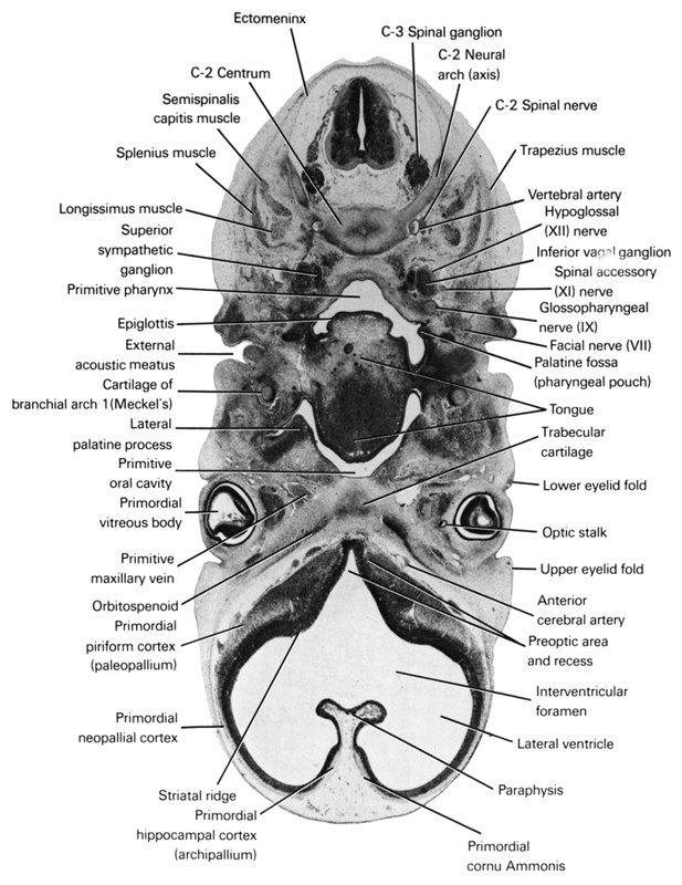 C-2 centrum, C-2 neural arch (axis), C-2 spinal nerve, C-3 spinal ganglion, anterior cerebral artery, ectomeninx, epiglottis, external acoustic meatus, facial nerve (CN VII), glossopharyngeal nerve (CN IX), hypoglossal nerve (CN XII), inferior ganglion of vagus nerve (CN X), interventricular foramen, lateral palatine process, lateral ventricle, longissimus muscle, lower eyelid fold, optic stalk, orbitosphenoid, palatine fossa (pharyngeal pouch), paraphysis, pharyngeal arch 1 cartilage (Meckel), preoptic area and recess, primitive maxillary vein, primitive oral cavity, primitive pharynx, primordial cornu Ammonis, primordial hippocampal cortex (archipallium), primordial neopallial cortex, primordial piriform cortex (paleopallium), primordial vitreous body, semispinalis capitis muscle, spinal accessory nerve (CN XI), splenius muscle, striatal ridge, superior sympathetic ganglion, tongue, trabecular cartilage, trapezius muscle, upper eyelid fold, vertebral artery