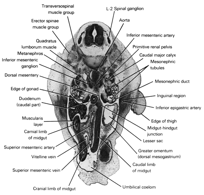 L-2 spinal ganglion, aorta, caudal limb of midgut, caudal major calyx, cranial limb of midgut, dorsal mesentery, duodenum (caudal part), edge of gonad, edge of thigh, erector spinae muscle group, greater omentum (dorsal mesogastrium), inferior epigastric artery, inferior mesenteric artery, inferior mesenteric ganglion, inguinal region, lesser  sac, mesonephric duct, mesonephric tubule(s), metanephros, midgut-hindgut junction, muscularis layer, primitive renal pelvis, quadratus lumborum muscle, superior mesenteric artery, superior mesenteric vein, transversospinal muscle group, umbilical coelom, vitelline (omphalomesenteric) vein