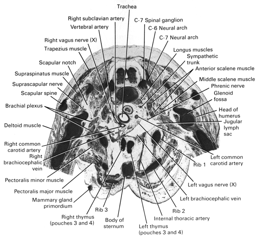 C-6 neural arch, C-7 neural arch, C-7 spinal ganglion, anterior scalene muscle, body of sternum, brachial plexus, deltoid muscle, glenoid fossa, head of humerus, internal thoracic artery, jugular lymph sac, left brachiocephalic vein, left common carotid artery, left thymus (pouches 3 and 4), left vagus nerve (CN X), longus muscles, mammary gland primordium, middle scalene muscle, pectoralis major muscle, pectoralis minor muscle, phrenic nerve, rib 1, rib 2, rib 3, right brachiocephalic vein, right common carotid artery, right subclavian artery, right thymus (pouches 3 and 4), right vagus nerve (CN X), scapular notch, scapular spine, suprascapular nerve, supraspinatus muscle, sympathetic trunk, trachea, trapezius muscle, vertebral artery