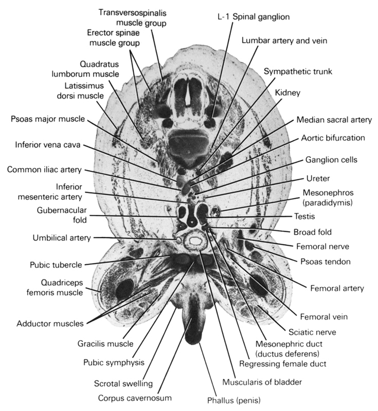 L-1 spinal ganglion, adductor muscles, aortic bifurcation, broad fold, common iliac artery, corpus cavernosum, erector spinae muscle group, femoral artery, femoral nerve, femoral vein, ganglion cells, gracilis muscle, gubernacular fold, inferior mesenteric artery, inferior vena cava, kidney, latissimus dorsi muscle, lumbar artery and vein, median sacral artery, mesonephric duct (ductus deferens), mesonephros (paradidymis), phallus (penis), psoas major muscle, psoas tendon, pubic symphysis, pubic tubercle, quadratus lumborum muscle, quadriceps femoris muscle, regressing female duct, sciatic nerve, scrotal swelling, sympathetic trunk, testis, transversospinalis muscle group, umbilical artery, ureter, urinary bladder muscularis