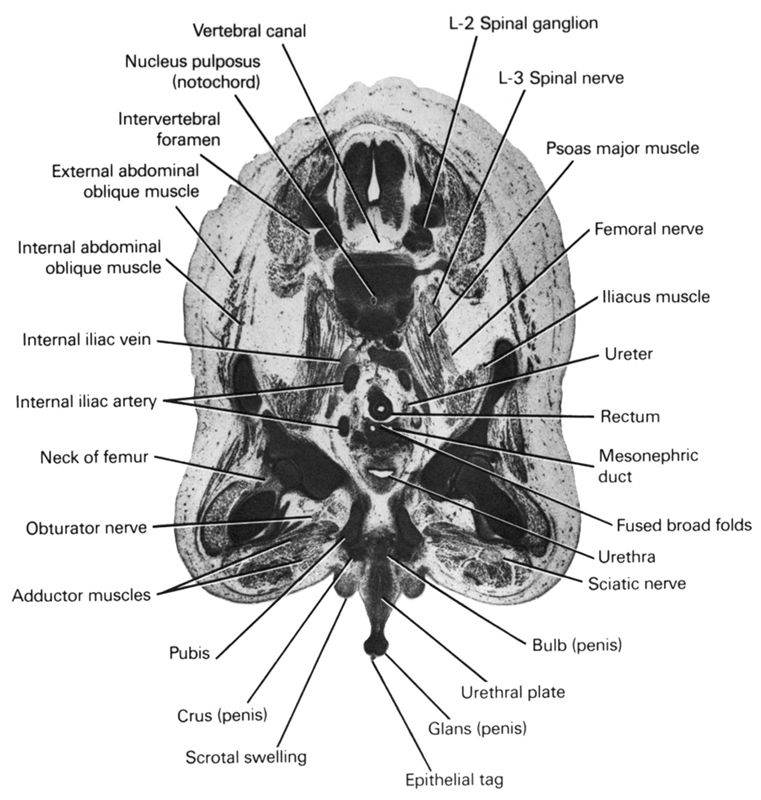 L-2 spinal ganglion, L-3 spinal nerve, adductor muscles, bulb (penis), crus (penis), epithelial tag, external abdominal oblique muscle, femoral nerve, fused broad folds, glans (penis), iliacus muscle, internal abdominal oblique muscle, internal iliac artery, internal iliac vein, intervertebral foramen, mesonephric duct, neck of femur, nucleus pulposus (notochord), obturator nerve, psoas major muscle, pubis, rectum, sciatic nerve, scrotal swelling, ureter, urethra, urethral plate, vertebral canal