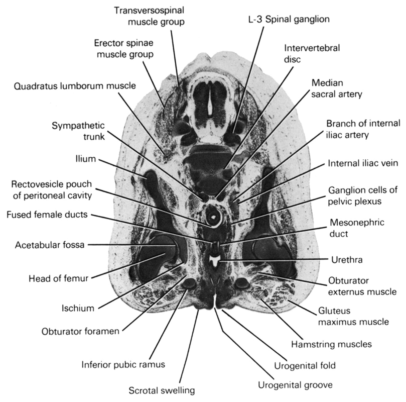 L-3 spinal ganglion, acetabular fossa, branch of internal iliac artery, erector spinae muscle group, fused female ducts, ganglion cells of pelvic plexus, gluteus maximus muscle, hamstring muscles, head of femur, ilium, inferior pubic ramus, internal iliac vein, intervertebral disc, ischium, median sacral artery, mesonephric duct, obturator externus muscle, obturator foramen, quadratus lumborum muscle, rectovesicle pouch of peritoneal cavity, scrotal swelling, sympathetic trunk, transversospinal muscle group, urethra, urogenital fold, urogenital groove