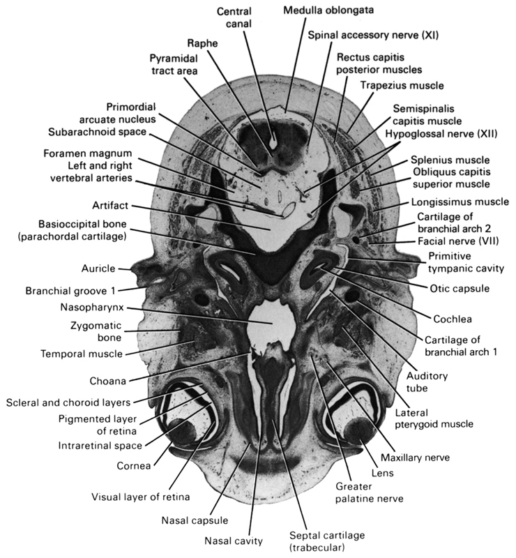 artifact(s), auditory tube, auricle, basi-occipital bone (parachordal cartilage), cartilage of pharyngeal arch 2, central canal, choana, cochlea, cornea, facial nerve (CN VII), foramen magnum, greater palatine nerve, hypoglossal nerve (CN XII), intraretinal space (optic vesicle cavity), lateral pterygoid muscle, left and right vertebral arteries, lens, longissimus muscle, maxillary nerve (CN V₂), medulla oblongata, nasal capsule, nasal cavity (nasal sac), nasopharynx, obliquus capitis superior muscle, optic part of retina, otic capsule, pharyngeal arch 1 cartilage (Meckel), pharyngeal groove 1, pigmented layer of retina, primitive tympanic cavity, primordial arcuate nucleus, pyramidal tract area, raphe, rectus capitis posterior muscle, scleral and choroid layers, semispinalis capitis muscle, septal cartilage (trabecular), spinal accessory nerve (CN XI), splenius muscle, subarachnoid space, temporalis muscle, trapezius muscle, zygomatic bone