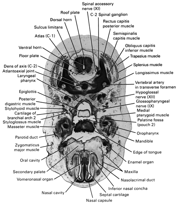 C-1 vertebra (atlas), C-2 spinal ganglion, atlanto-axial joint, cartilage of pharyngeal arch 2, dens of C-2 vertebra (axis), dorsal horn of grey matter, edge of tongue, enamel organ, epiglottis, floor plate, glossopharyngeal nerve (CN IX), hypoglossal nerve (CN XII), inferior nasal concha, laryngeal pharynx, longissimus muscle, mandible, masseter muscle, maxilla, medial pterygoid muscle, nasal capsule, nasal cavity (nasal sac), nasolacrimal duct, obliquus capitis inferior muscle, oral cavity, oropharynx, palatine fossa (pouch 2), parotid duct, posterior digastric muscle, rectus capitis posterior muscle, roof plate, secondary palate, semispinalis capitis muscle, septal cartilage, spinal accessory nerve (CN XI), splenius muscle, styloglossus muscle, stylohyoid muscle, sulcus limitans, trapezius muscle, ventral horn of grey matter, vertebral artery in transverse foramen, vomeronasal organ, zygomaticus major muscle