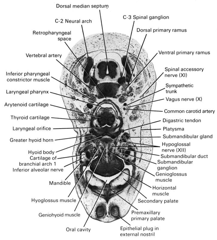 C-2 neural arch, C-3 spinal ganglion, arytenoid cartilage, body of hyoid (pharyngeal arch 3 cartilage), common carotid artery, digastric tendon, dorsal median septum, dorsal primary ramus, epithelial plug in external nostril, genioglossus muscle, geniohyoid muscle, greater horn of hyoid (pharyngeal arch 3 cartilage), horizontal muscle, hyoglossus muscle, hypoglossal nerve (CN XII), inferior alveolar nerve, inferior pharyngeal constrictor muscle, laryngeal orifice, laryngeal pharynx, mandible, oral cavity, pharyngeal arch 1 cartilage (Meckel), platysma, premaxillary primary palate, retropharyngeal space, secondary palate, spinal accessory nerve (CN XI), submandibular duct, submandibular ganglion, submandibular gland, sympathetic trunk, thyroid cartilage, vagus nerve (CN X), ventral primary ramus, vertebral artery