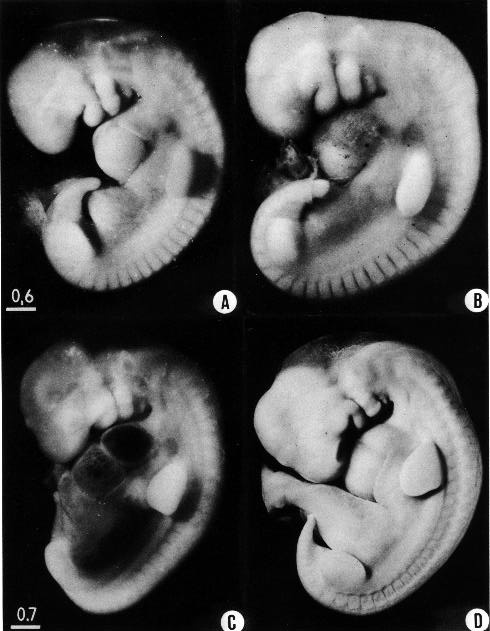 human embryo development timeline
